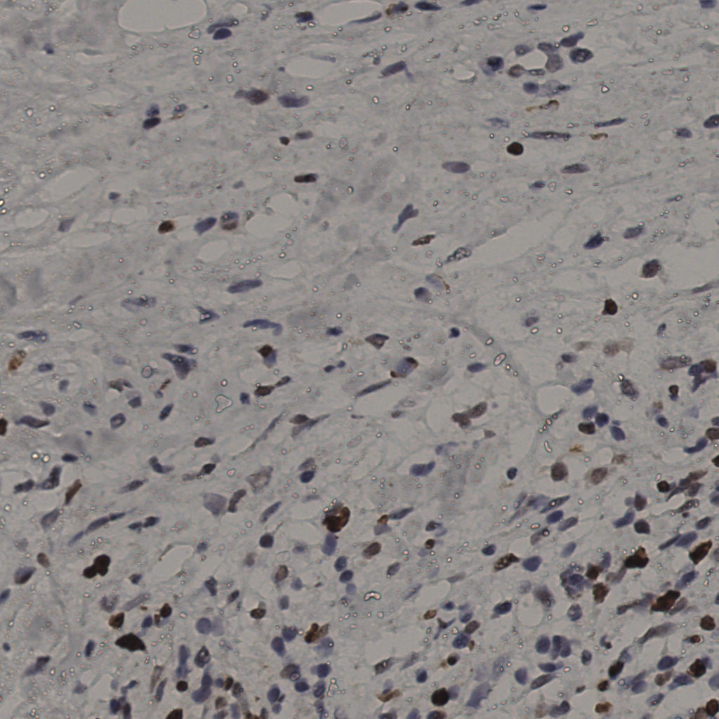 slice_36_21_x32256_y18816.png