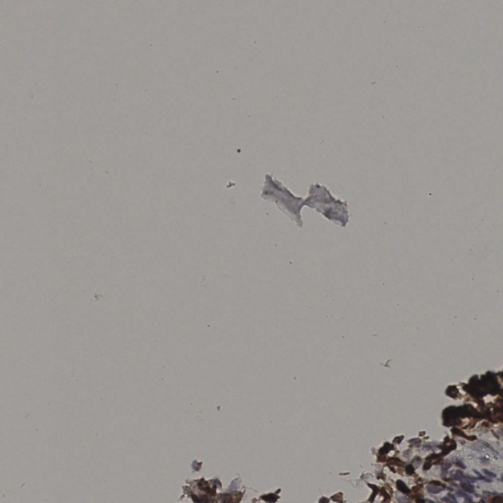 slice_36_3_x32256_y2688.png