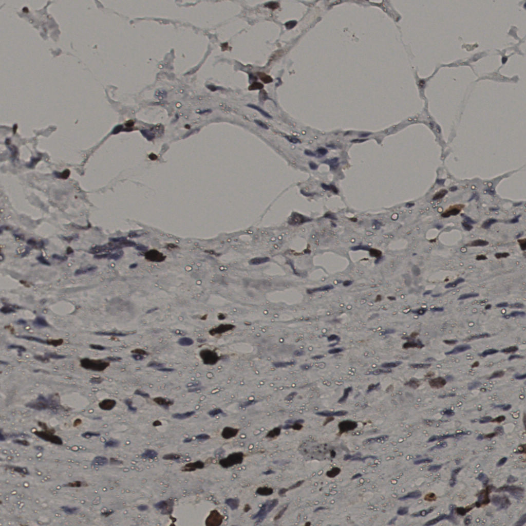 slice_36_9_x32256_y8064.png