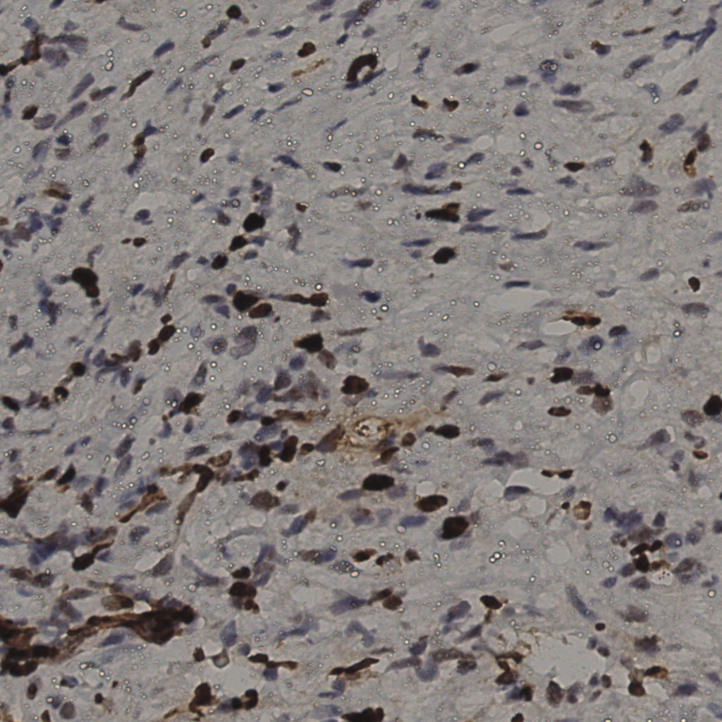 slice_37_10_x33152_y8960.png