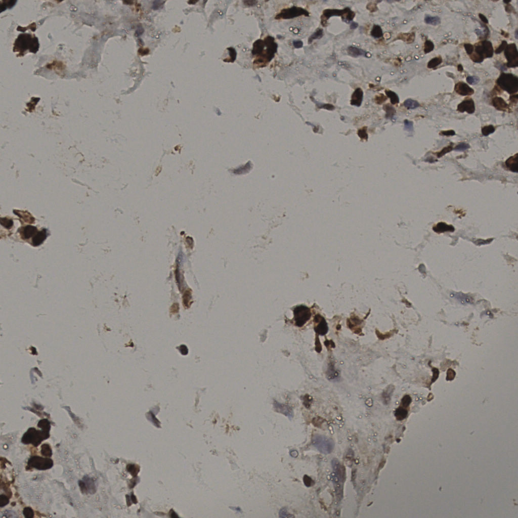 slice_37_12_x33152_y10752.png