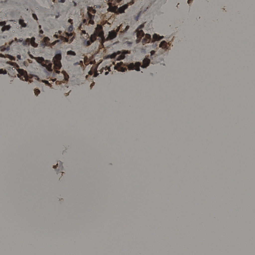 slice_37_14_x33152_y12544.png