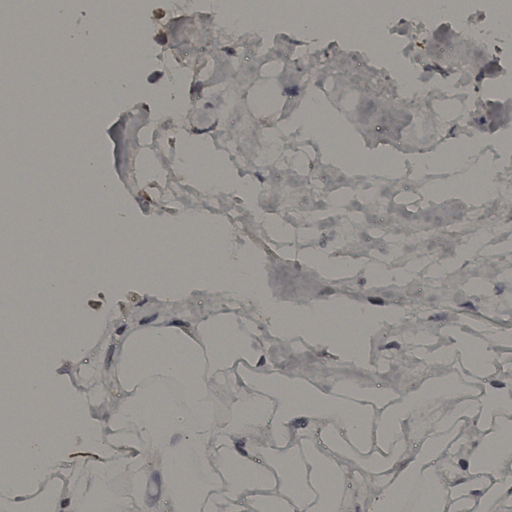 slice_37_17_x33152_y15232.png