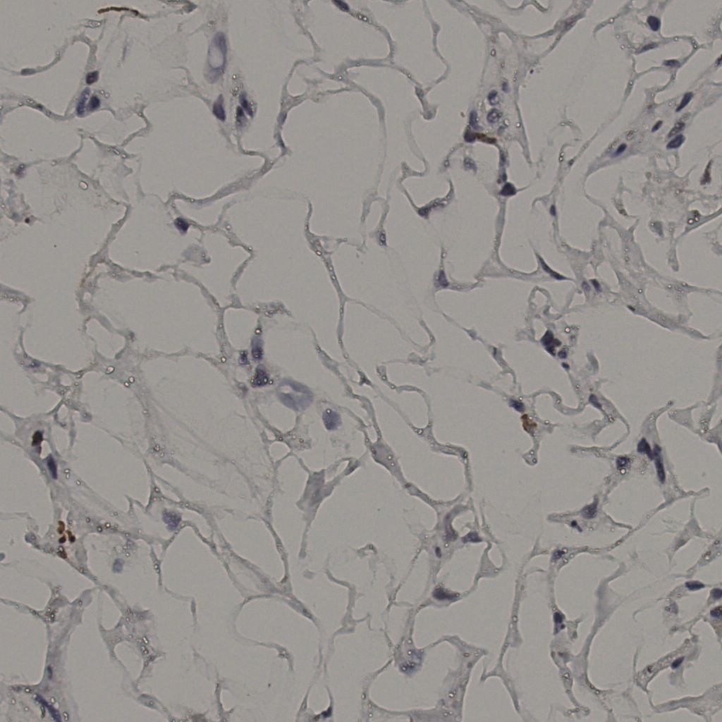 slice_37_18_x33152_y16128.png