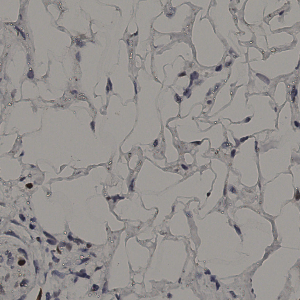 slice_37_19_x33152_y17024.png