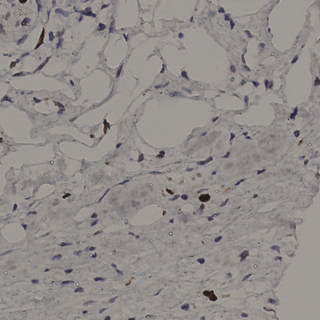 slice_37_20_x33152_y17920.png