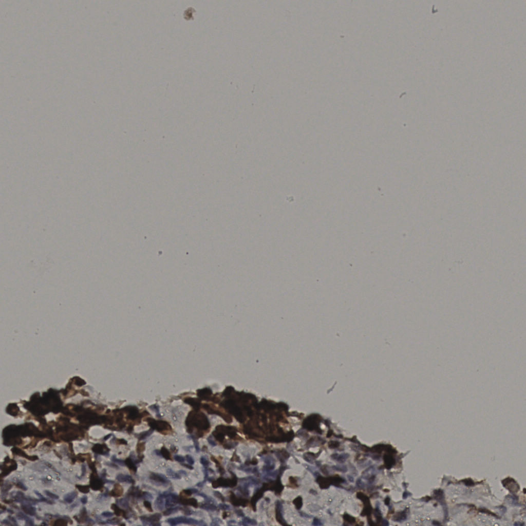 slice_37_3_x33152_y2688.png