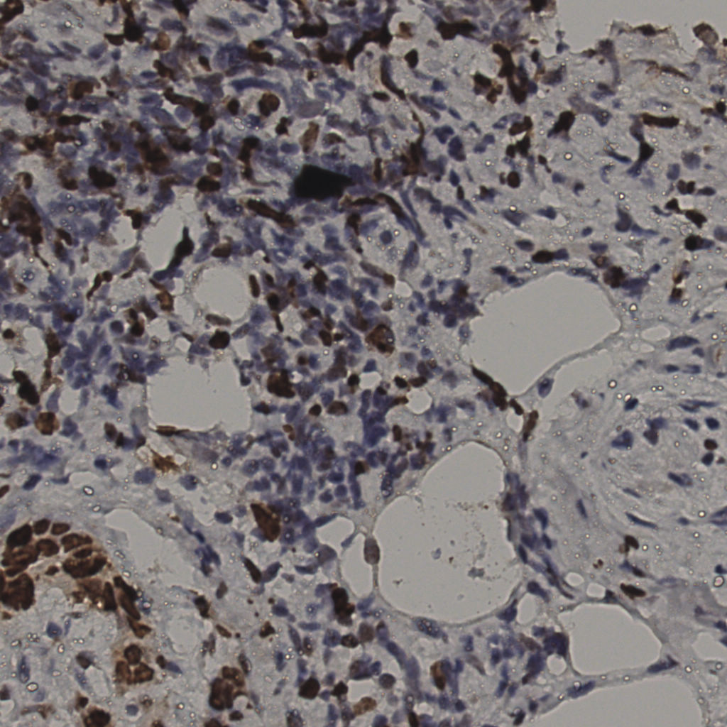 slice_37_4_x33152_y3584.png