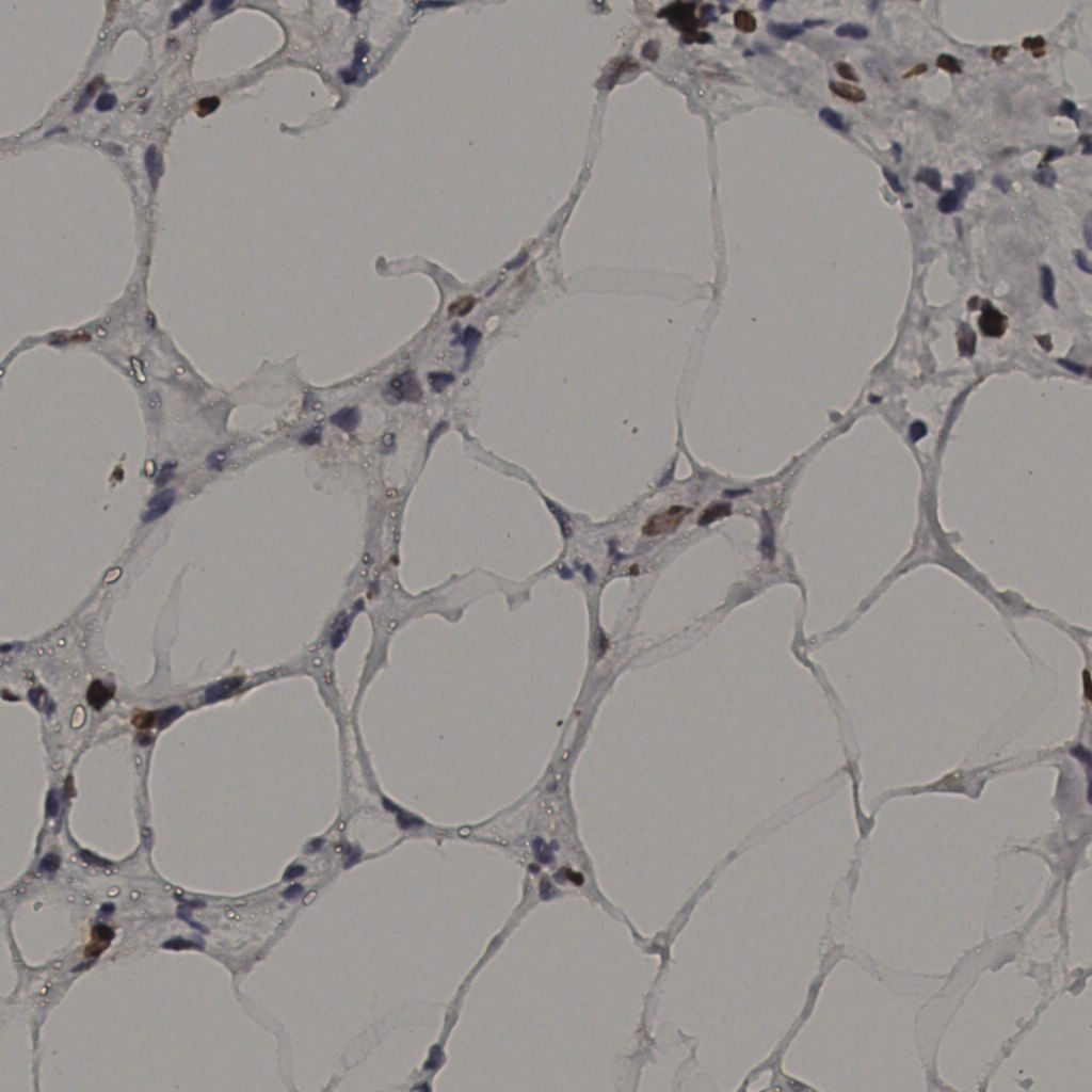 slice_37_6_x33152_y5376.png