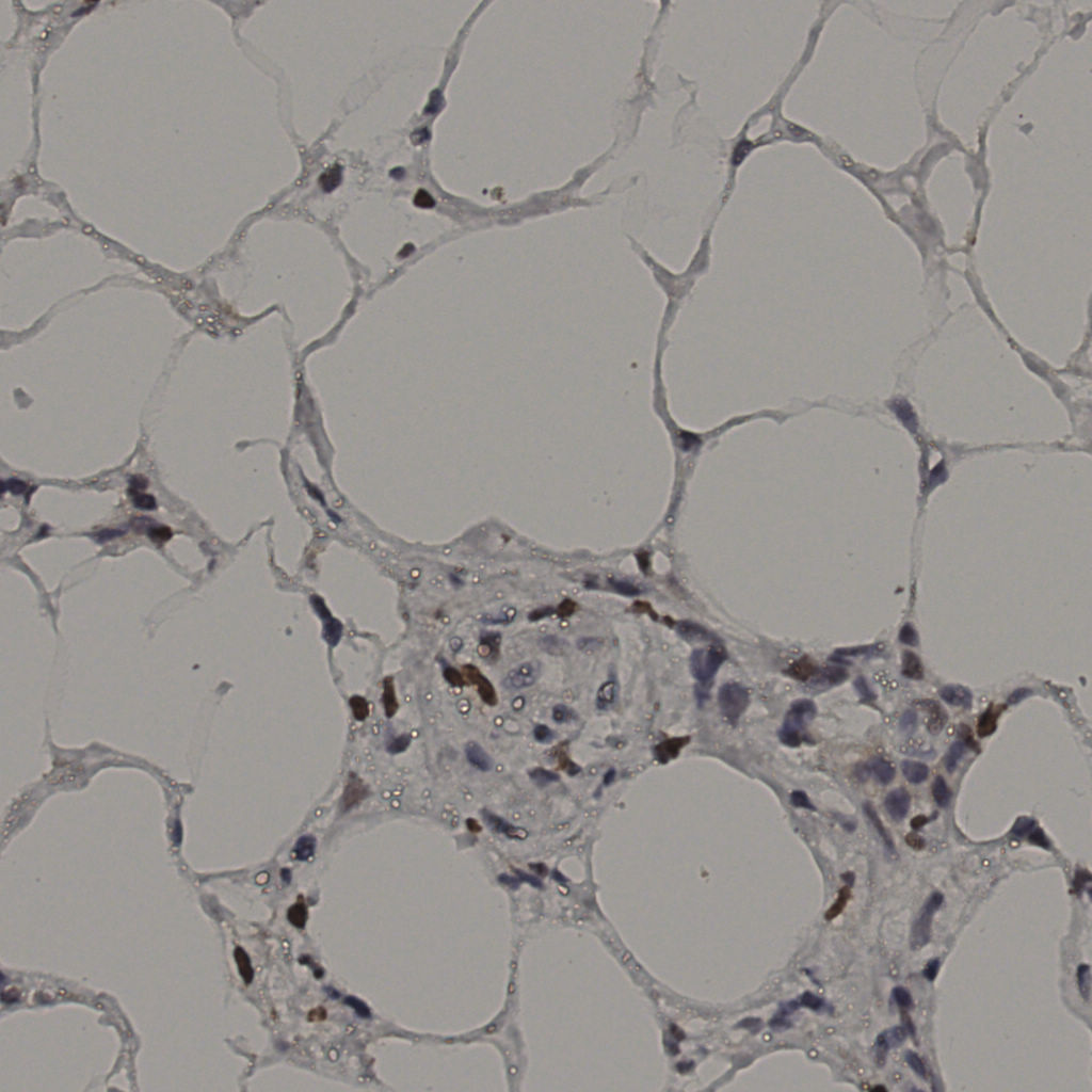 slice_37_7_x33152_y6272.png