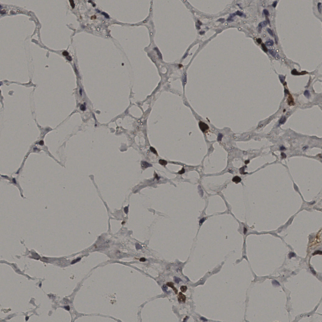 slice_37_8_x33152_y7168.png
