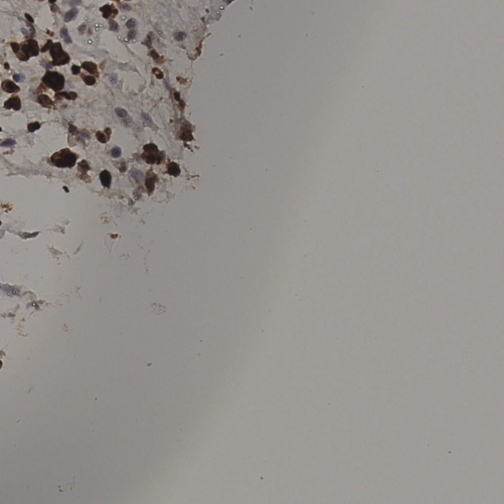 slice_38_12_x34048_y10752.png