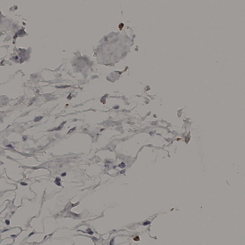 slice_38_17_x34048_y15232.png