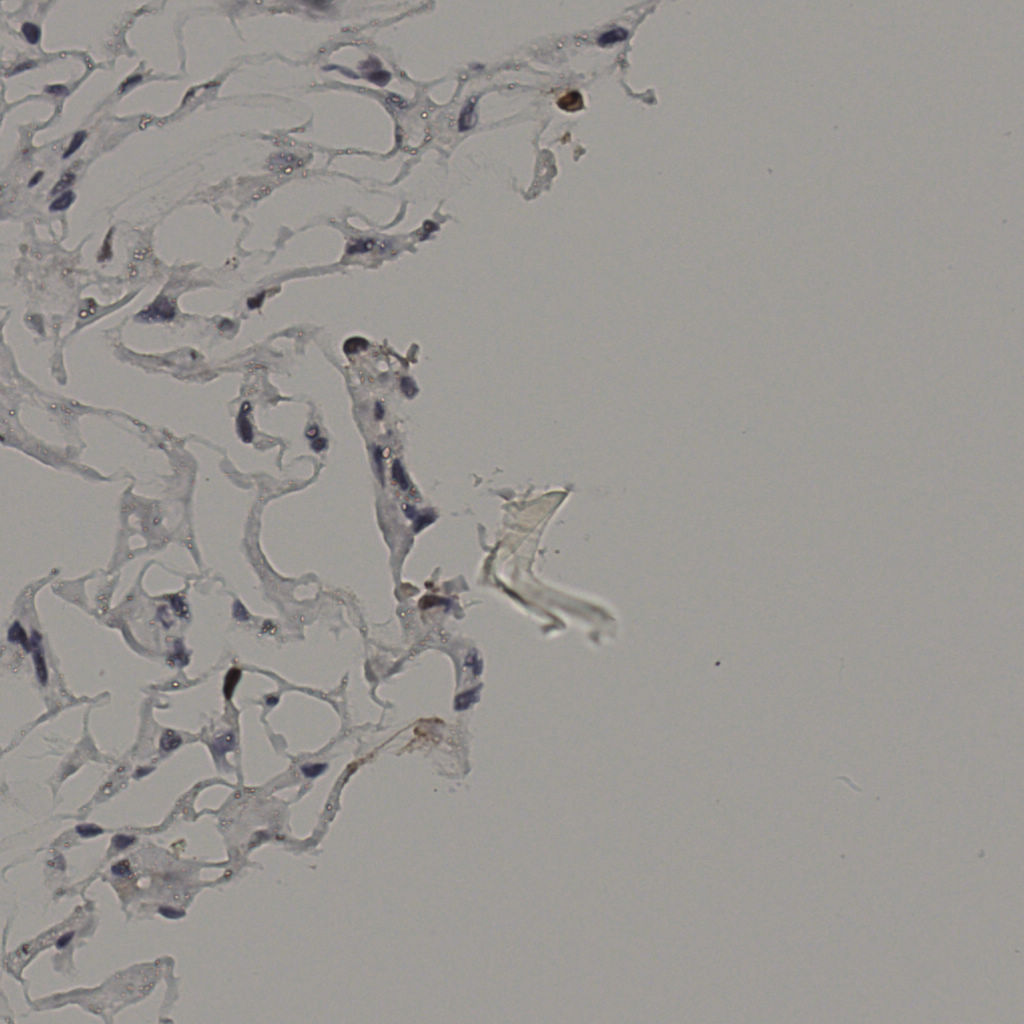 slice_38_18_x34048_y16128.png