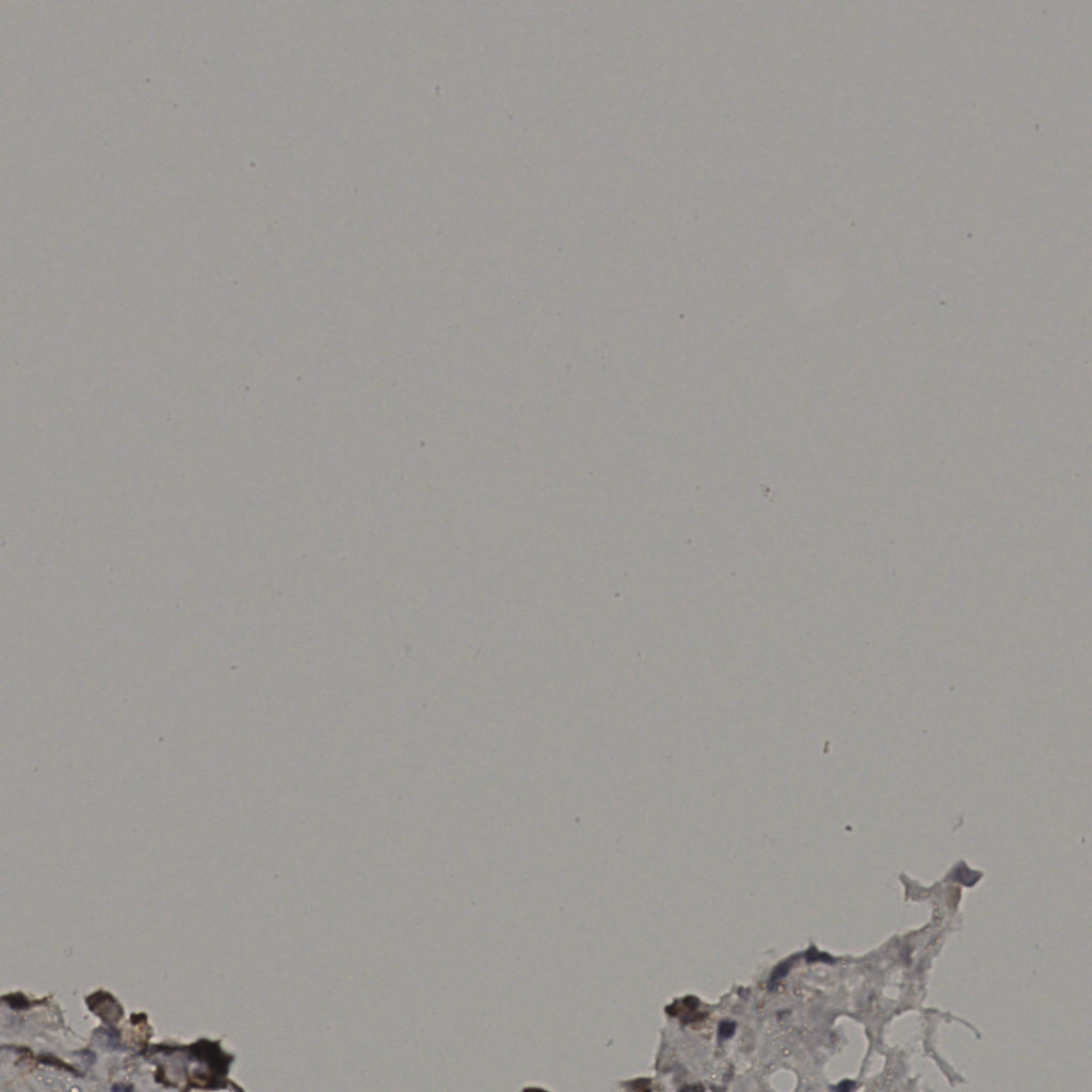 slice_38_3_x34048_y2688.png