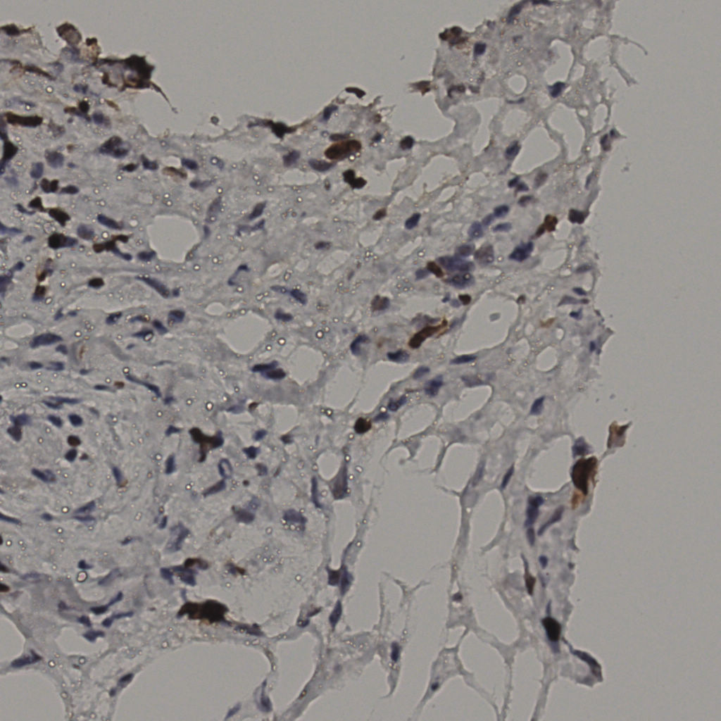 slice_38_4_x34048_y3584.png