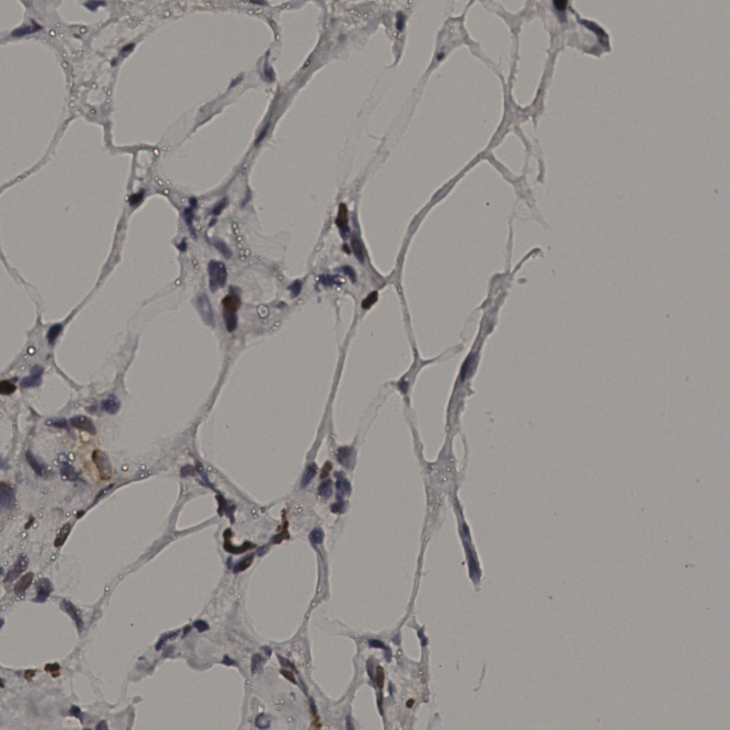 slice_38_5_x34048_y4480.png