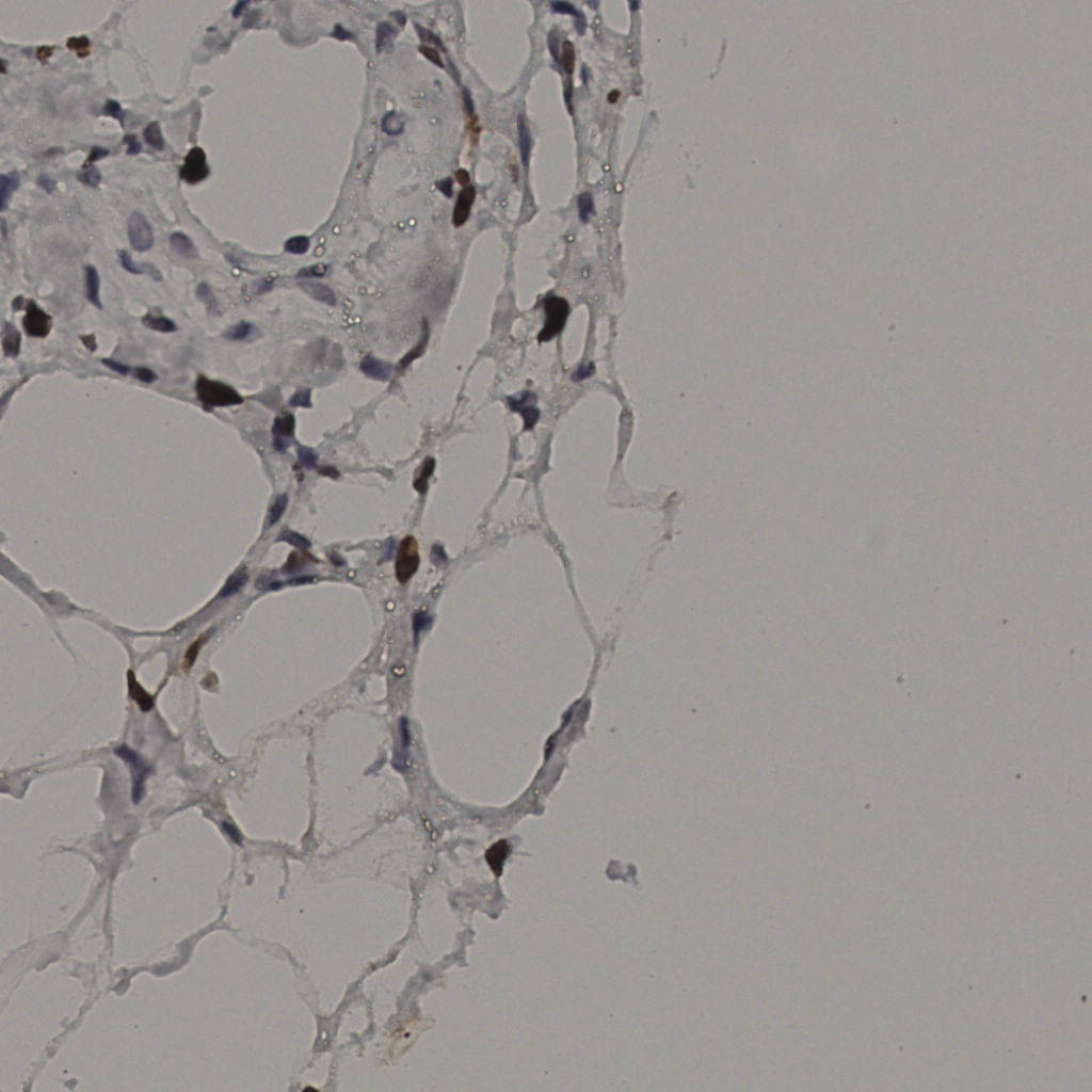 slice_38_6_x34048_y5376.png