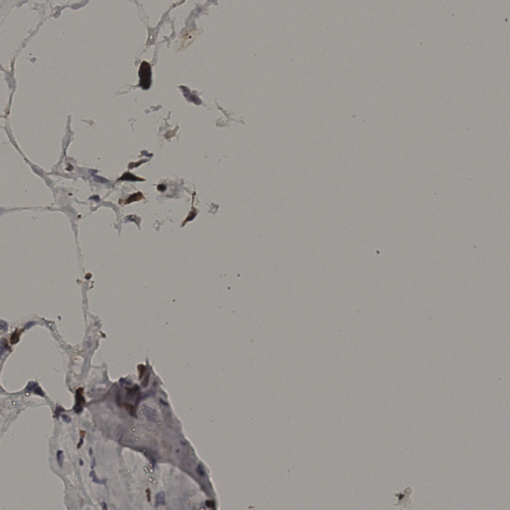 slice_38_7_x34048_y6272.png