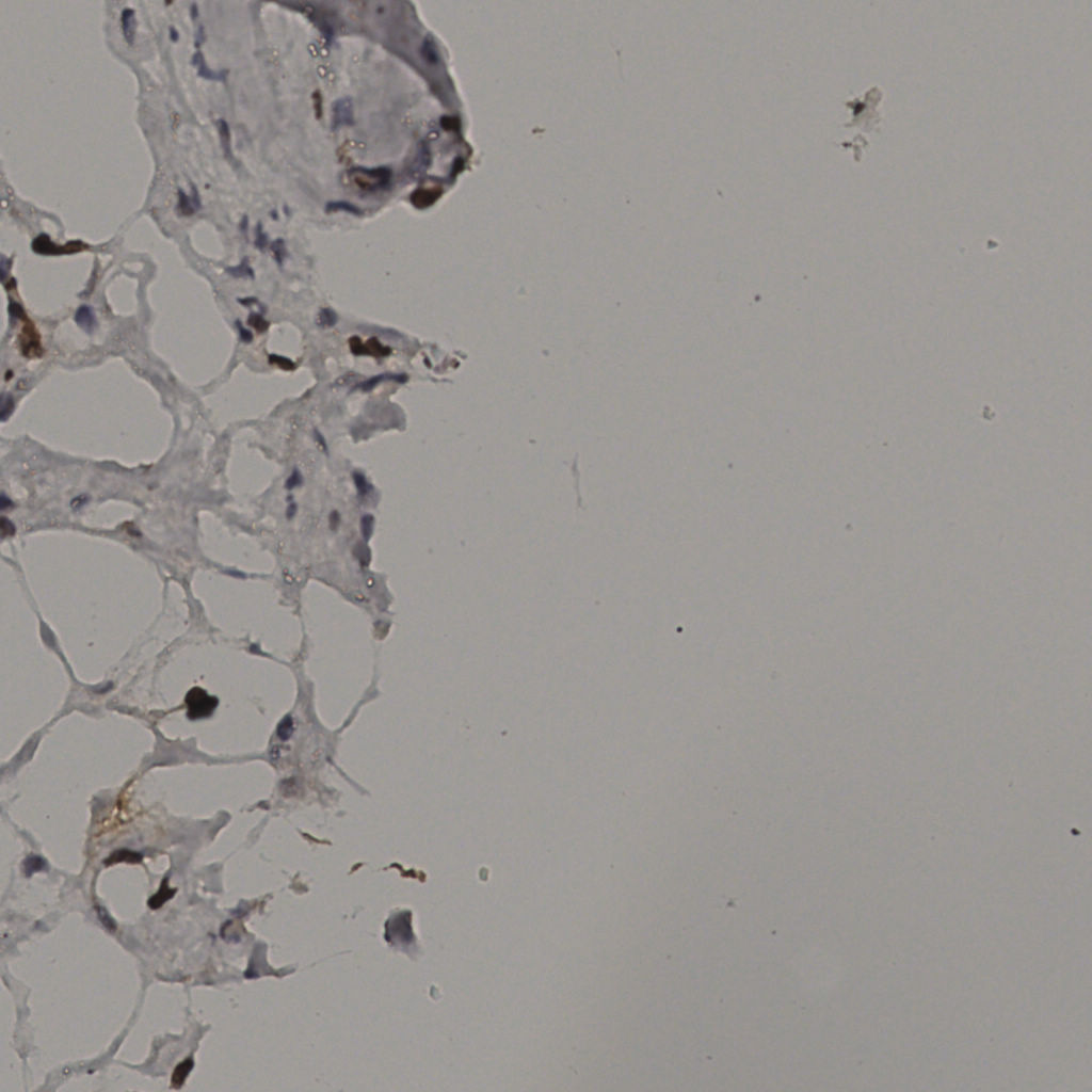 slice_38_8_x34048_y7168.png