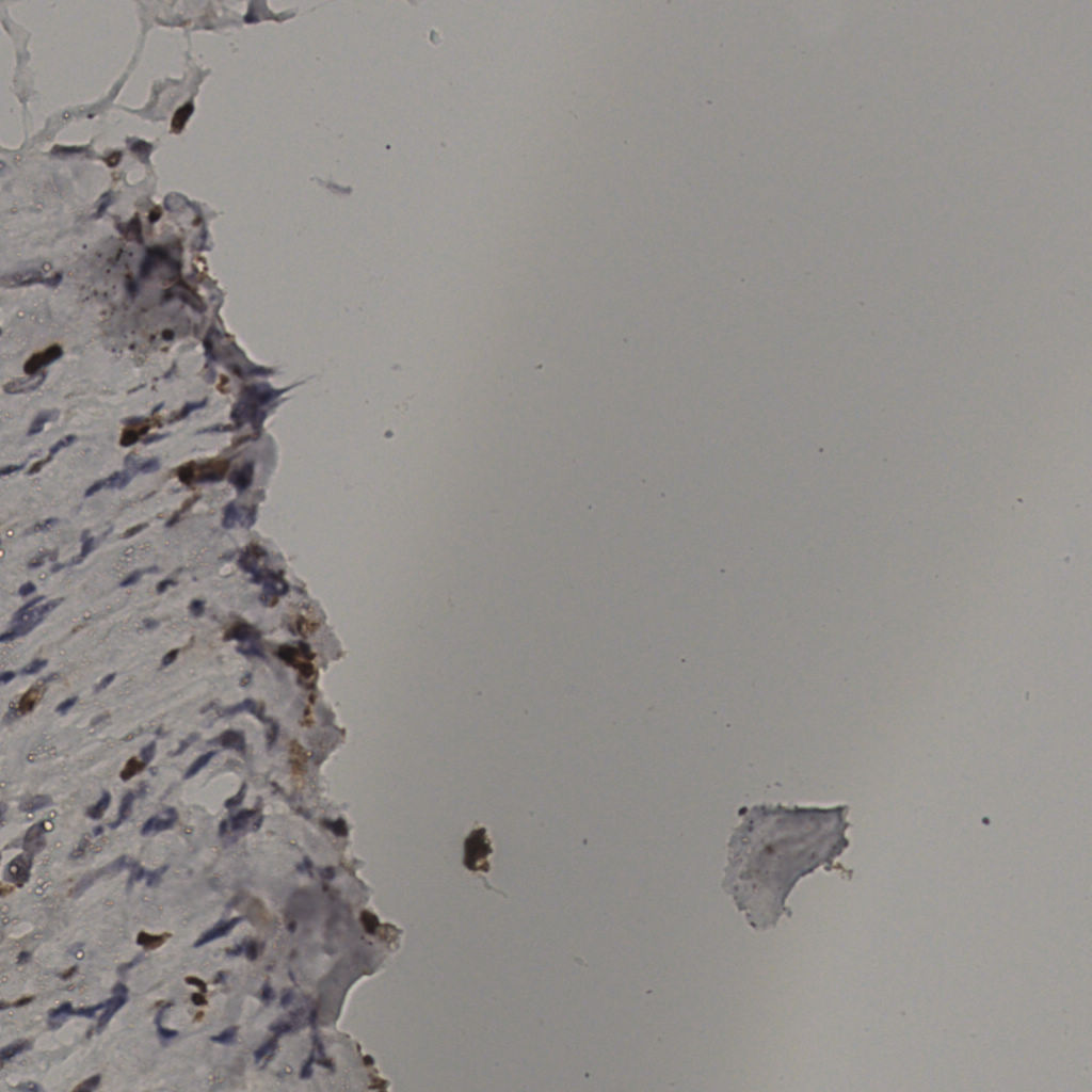 slice_38_9_x34048_y8064.png