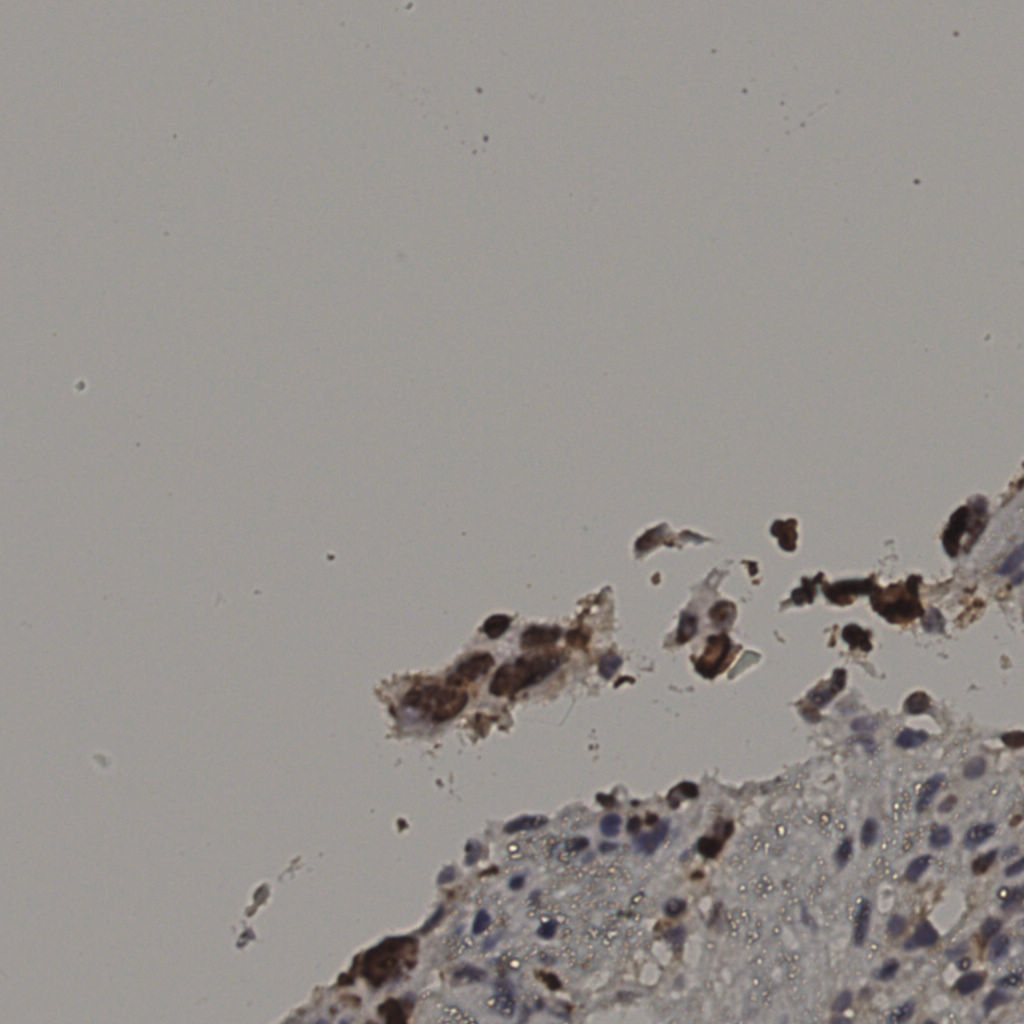 slice_5_50_x4480_y44800.png