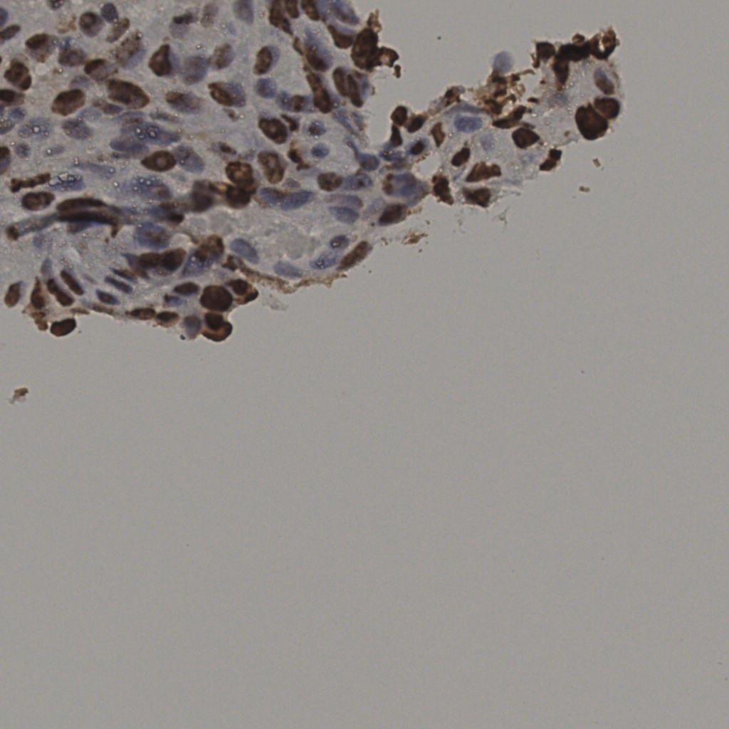 slice_5_60_x4480_y53760.png