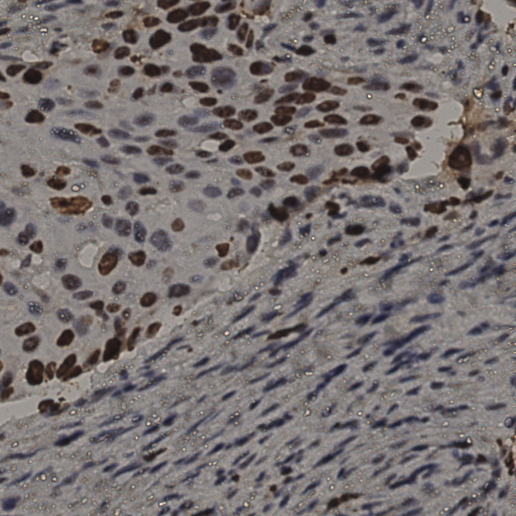 slice_7_56_x6272_y50176.png