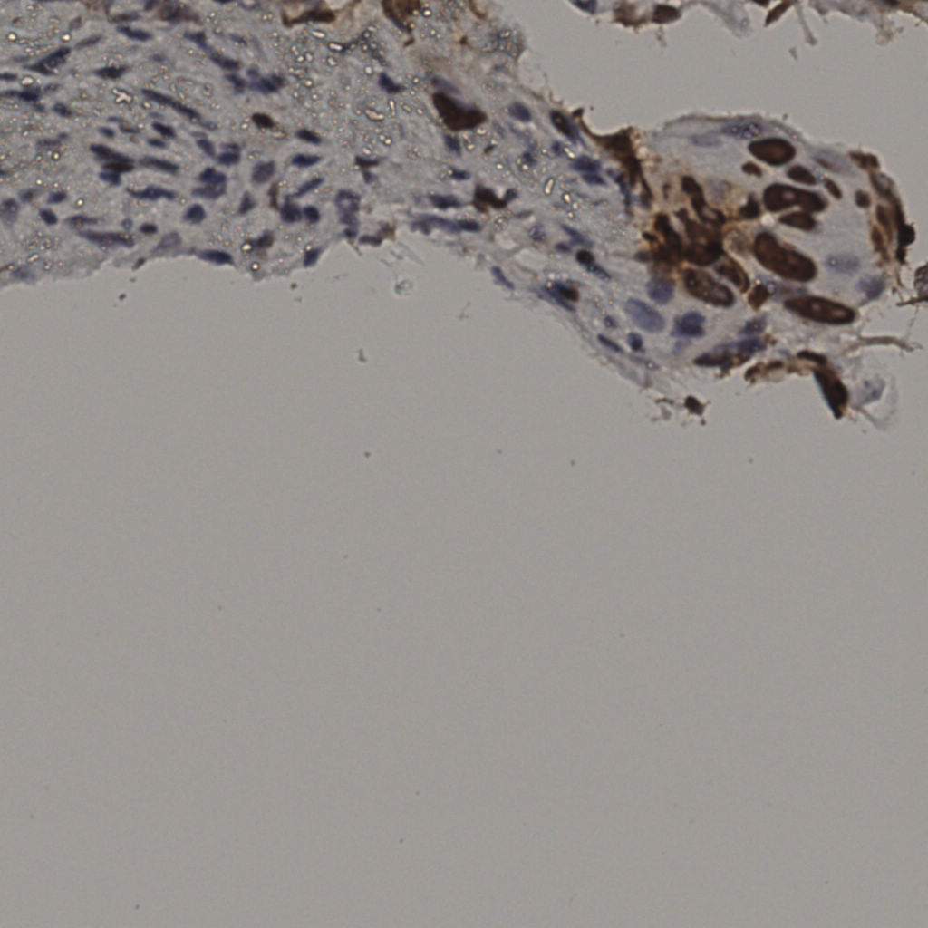 slice_7_59_x6272_y52864.png