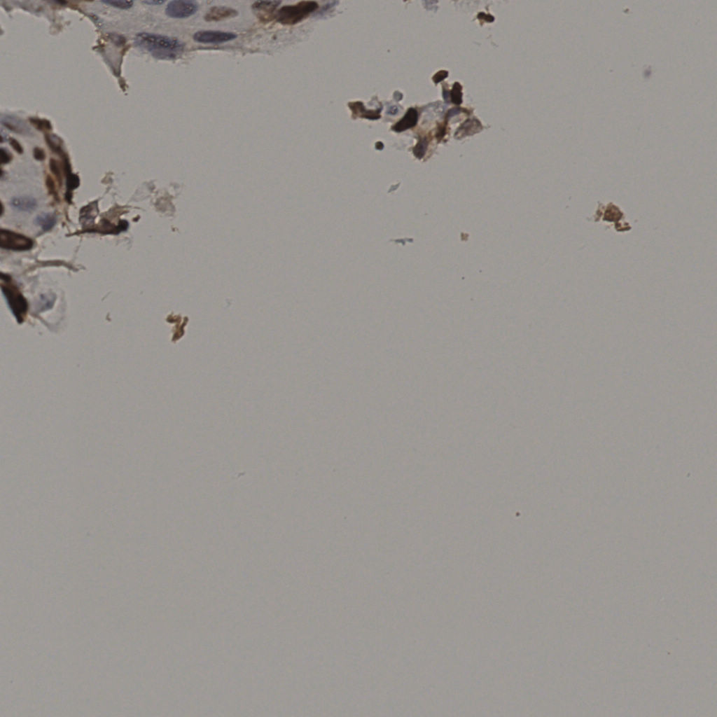 slice_8_59_x7168_y52864.png