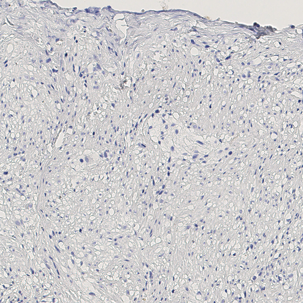 slice_10_19_x8960_y17024.png