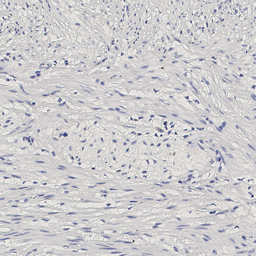 slice_10_20_x8960_y17920.png