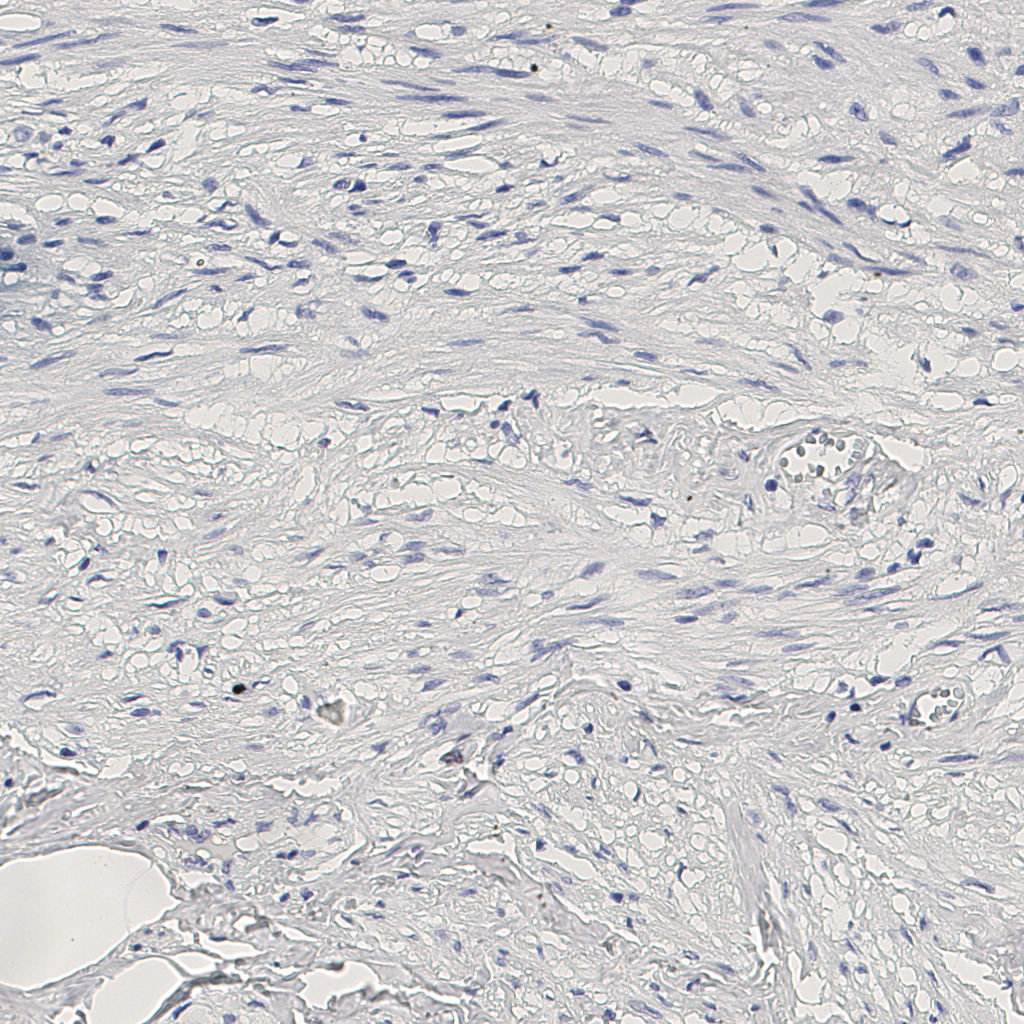 slice_10_21_x8960_y18816.png