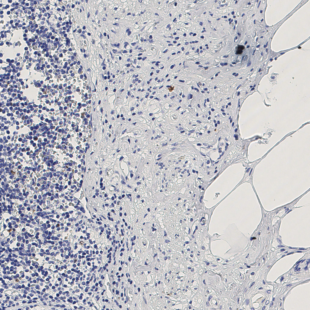 slice_10_24_x8960_y21504.png