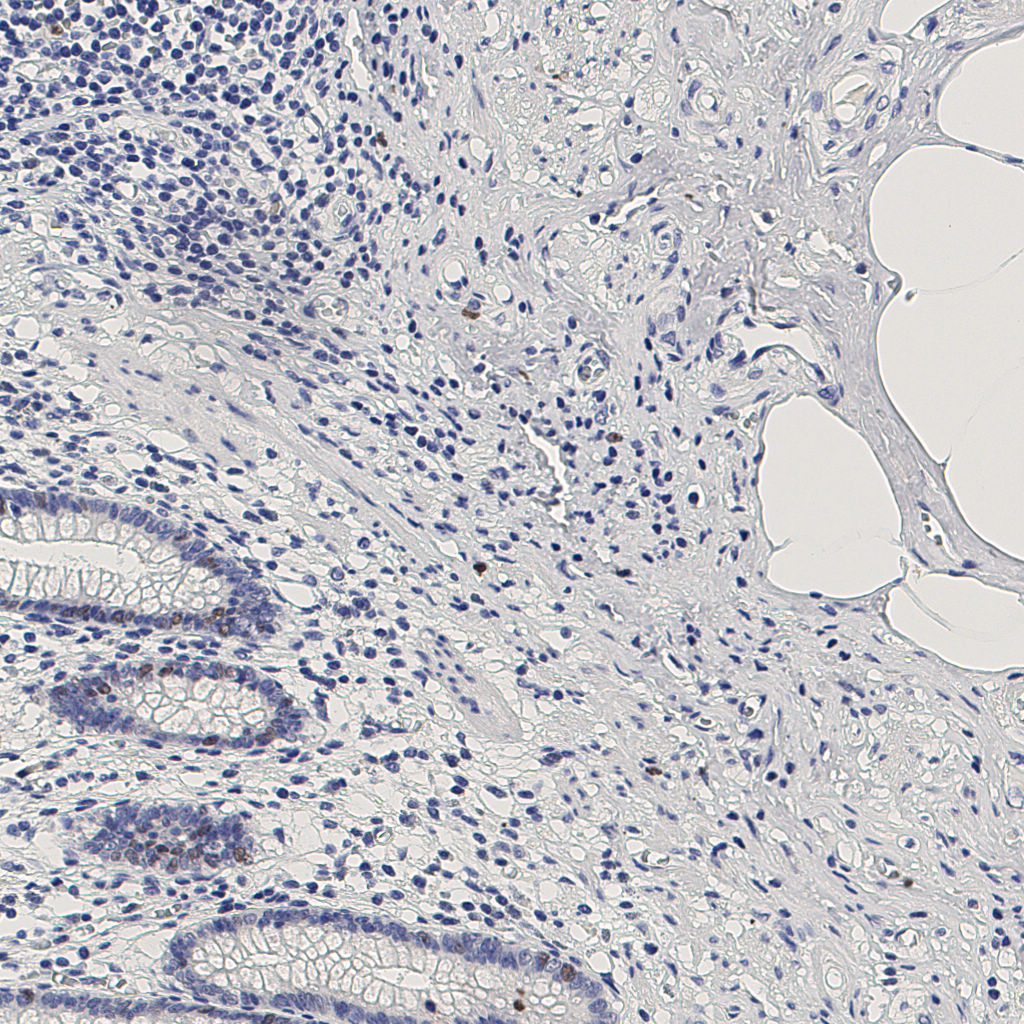 slice_10_25_x8960_y22400.png