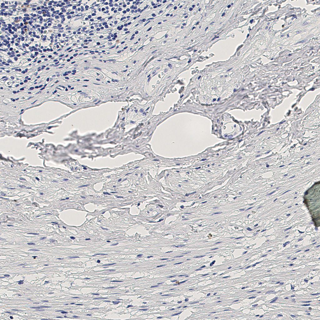 slice_10_27_x8960_y24192.png