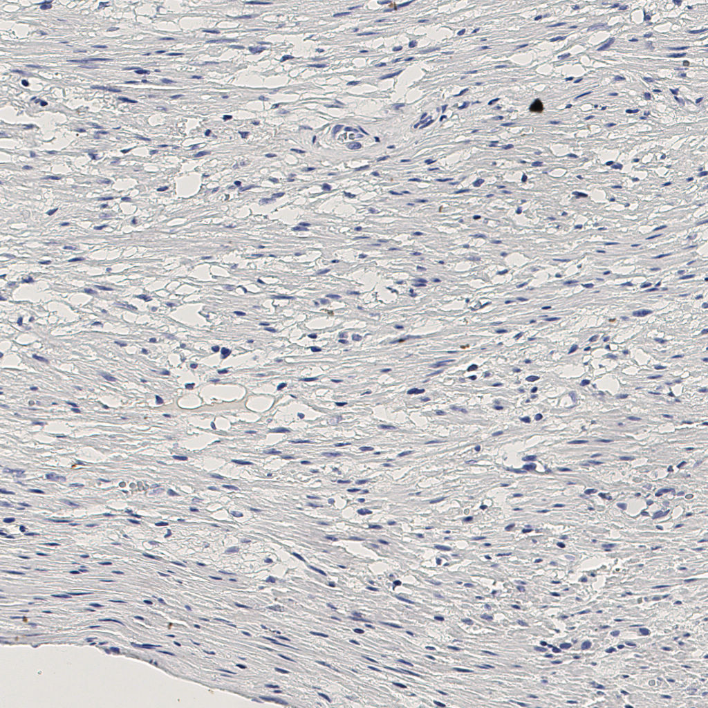 slice_10_28_x8960_y25088.png