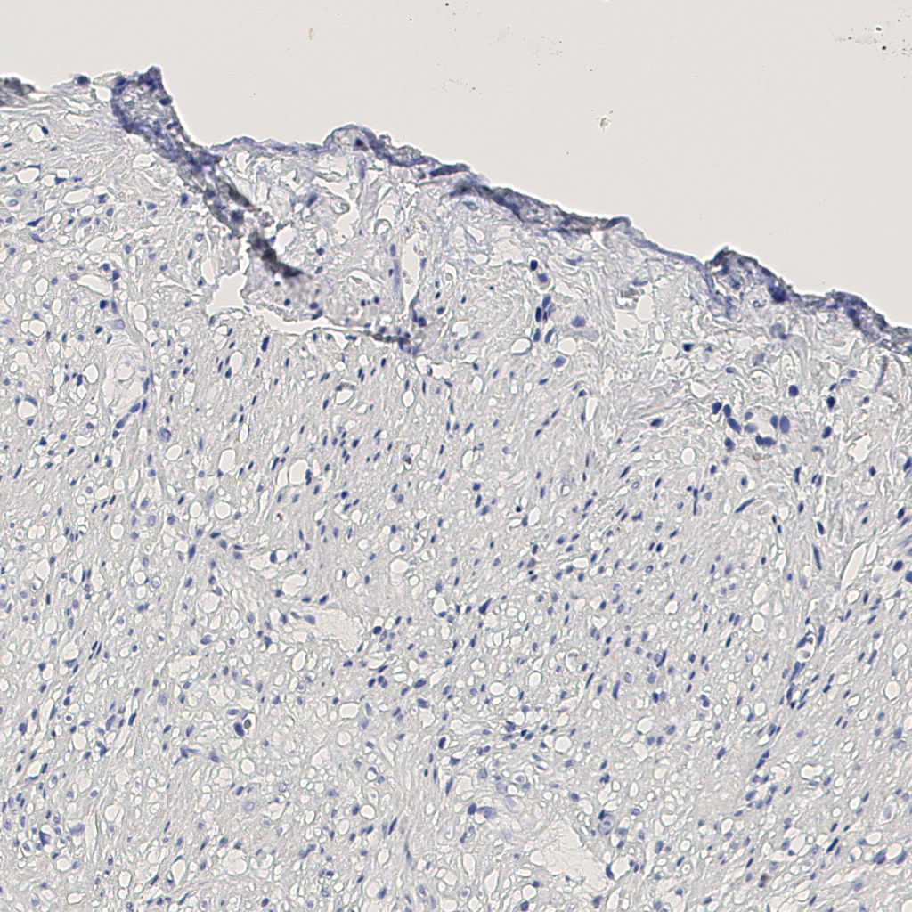 slice_11_19_x9856_y17024.png