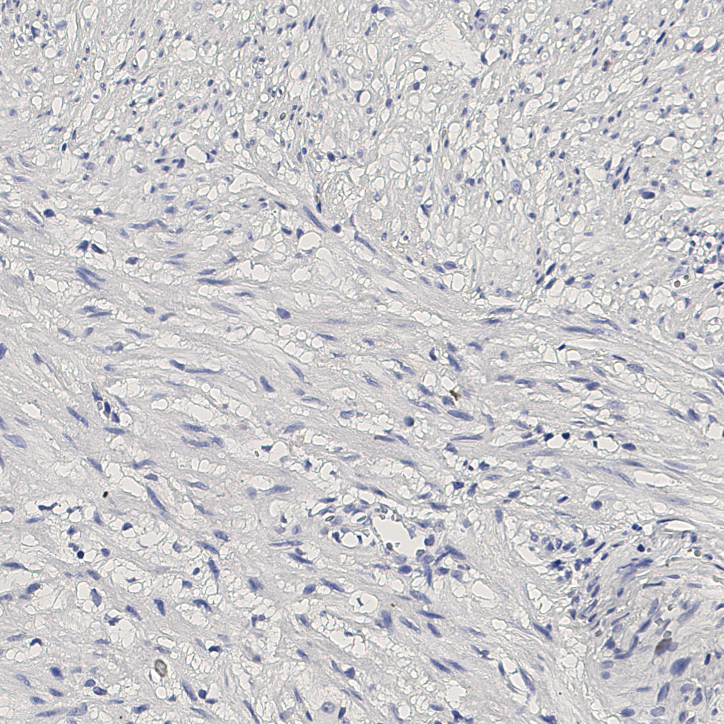 slice_11_20_x9856_y17920.png
