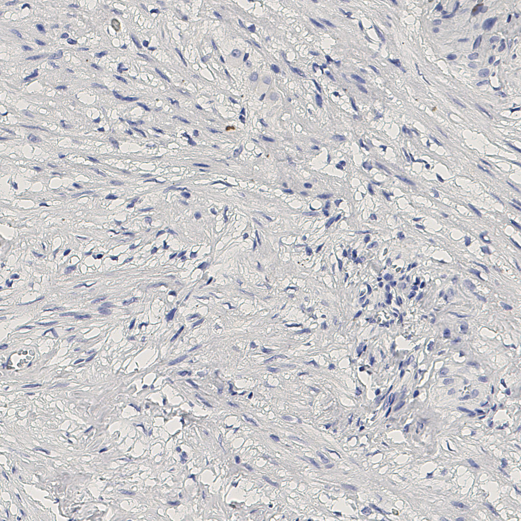 slice_11_21_x9856_y18816.png