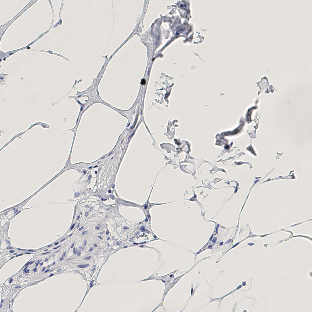 slice_11_24_x9856_y21504.png