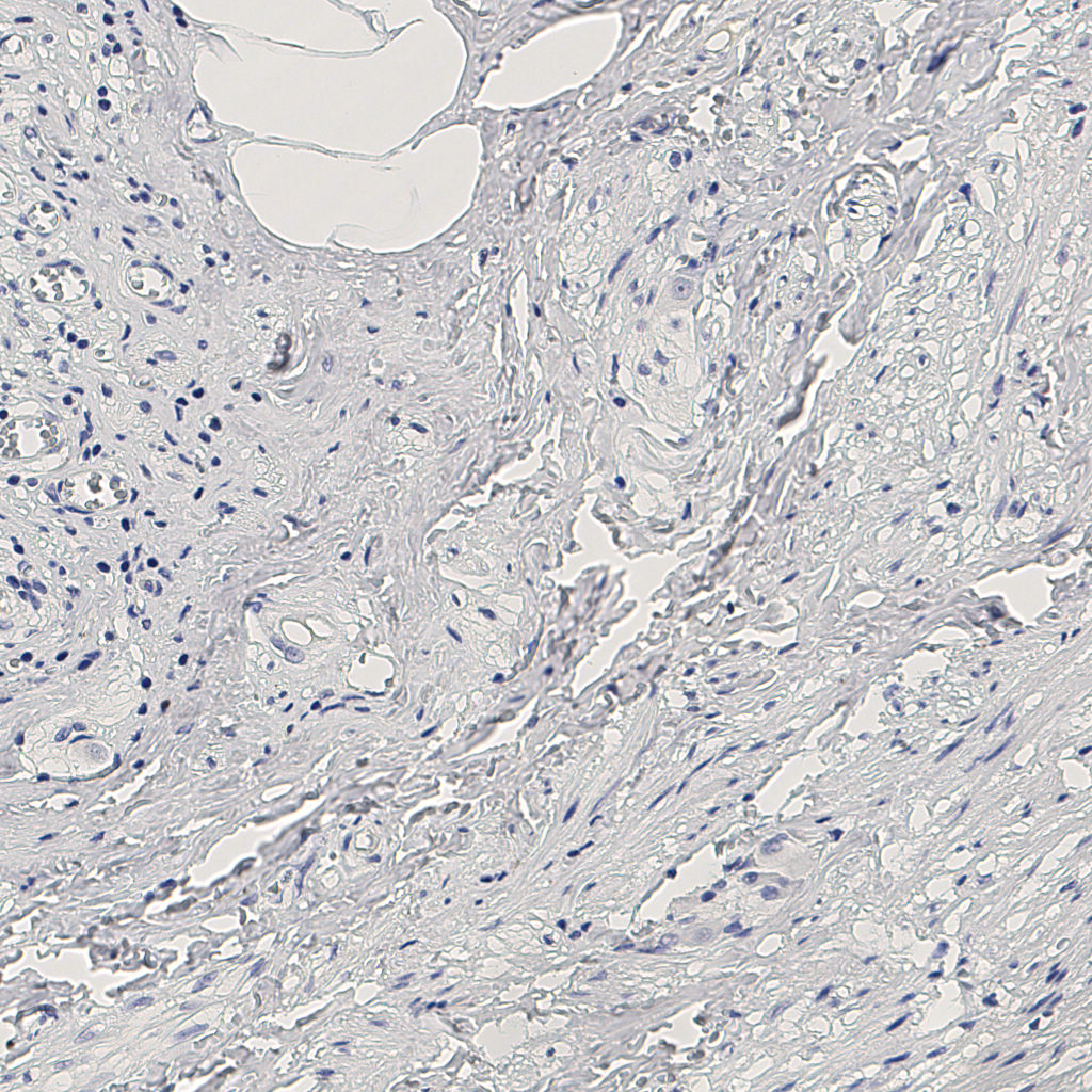 slice_11_26_x9856_y23296.png
