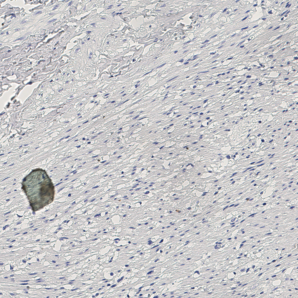 slice_11_27_x9856_y24192.png