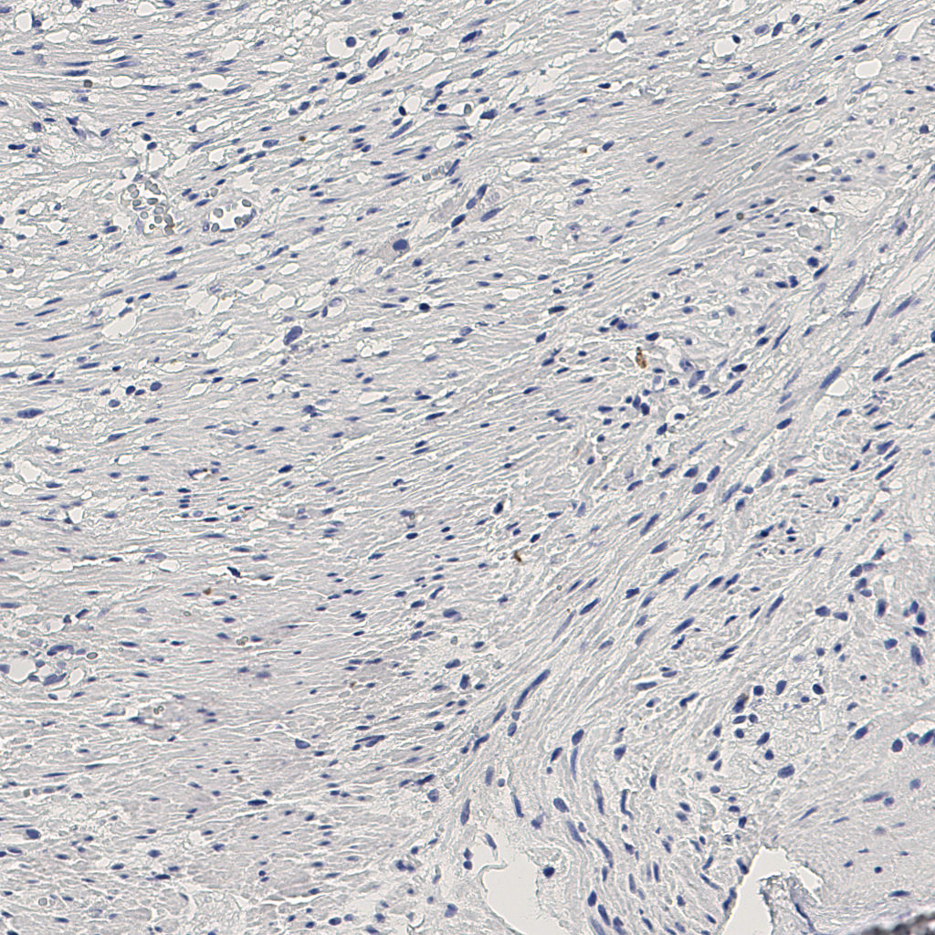 slice_11_28_x9856_y25088.png