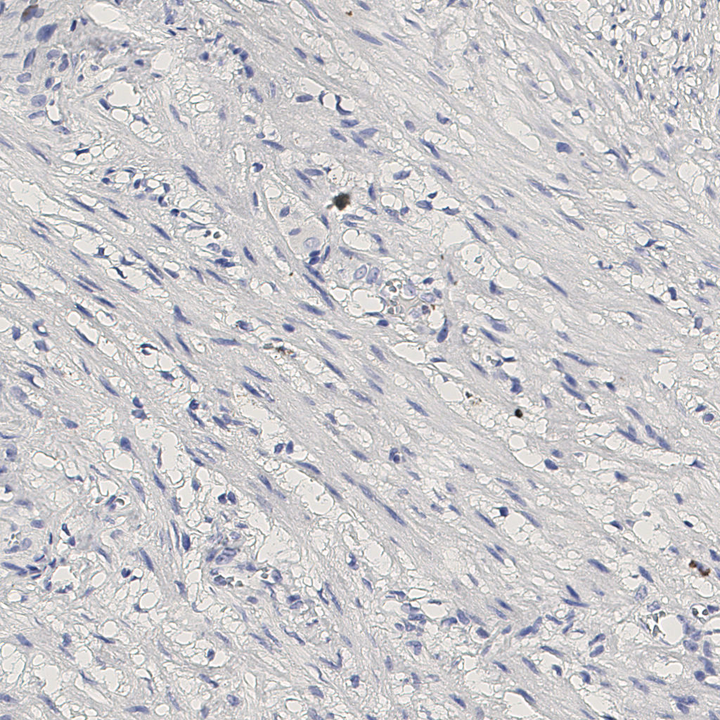 slice_12_21_x10752_y18816.png