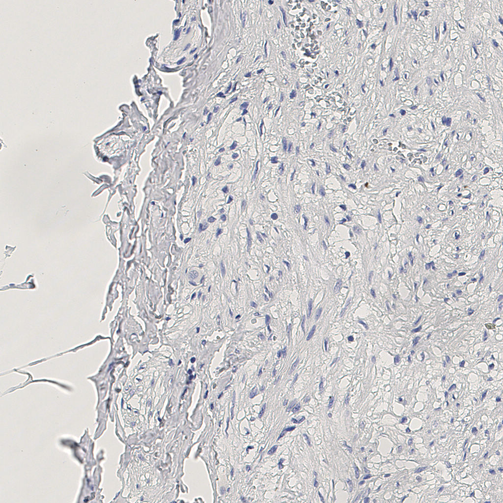 slice_12_24_x10752_y21504.png