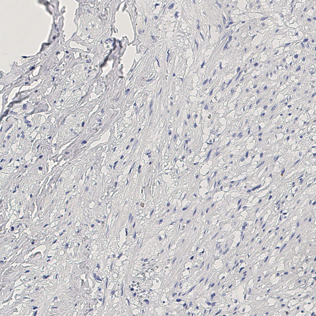 slice_12_25_x10752_y22400.png