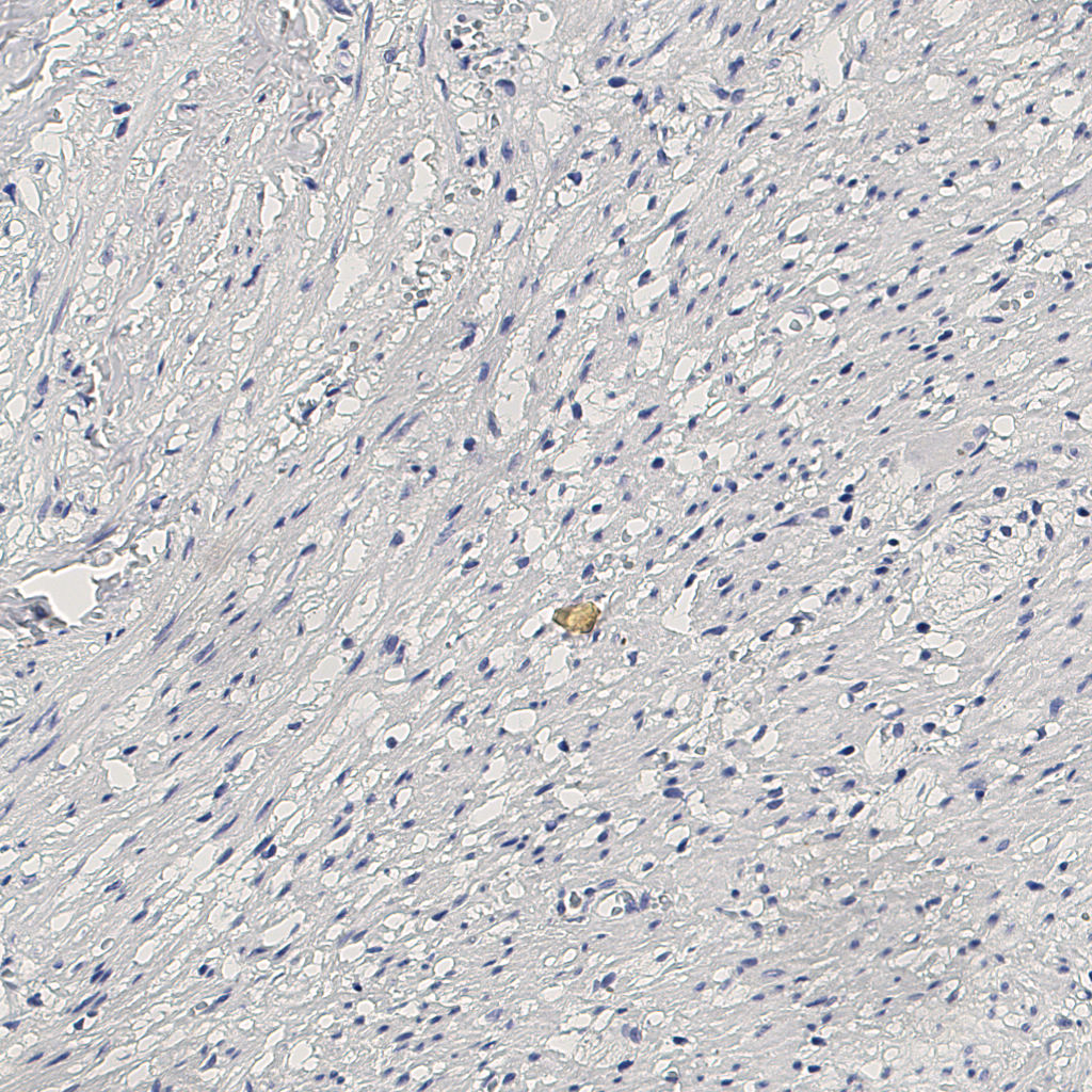 slice_12_26_x10752_y23296.png