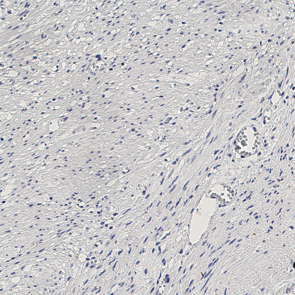 slice_12_27_x10752_y24192.png