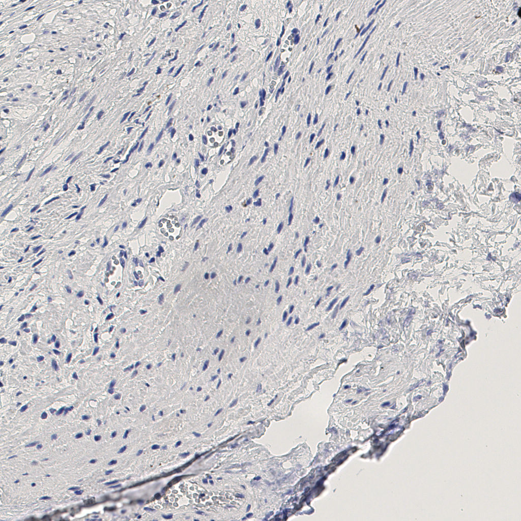 slice_12_28_x10752_y25088.png
